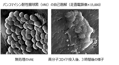 バンコマイシン耐性腸球菌(VRE)の自己融解