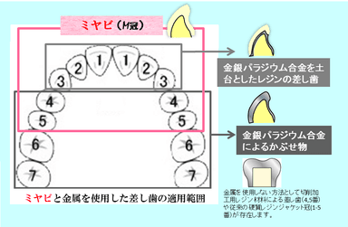 図1：ミヤビ健保適用範囲