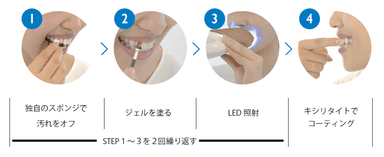 ホワイトニング工程