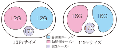 パワートリアライシス(R) カテーテル内腔