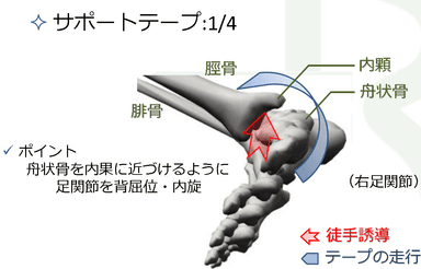 テーピング部分の効果