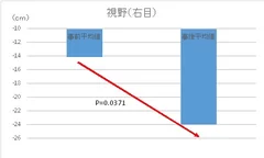 測定項目：視野(右目)