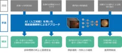 AIによる眼底画像の診断支援