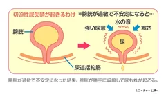 寒さが刺激となり「尿意」に敏感