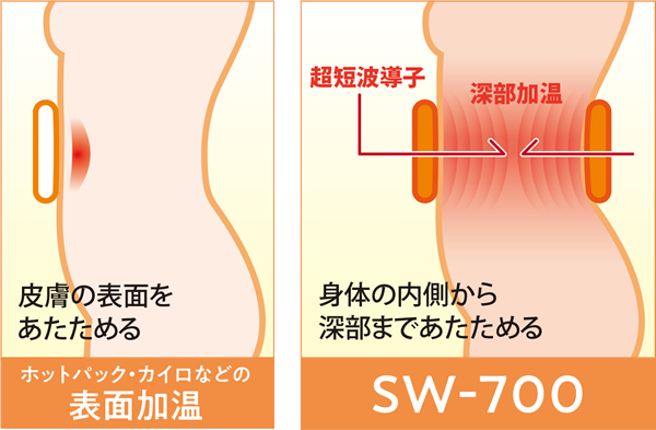 超短波による身体の深部をあたためる作用が大きくなった低周波・超短波