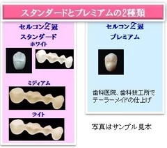 セルコンZ冠 サンプル