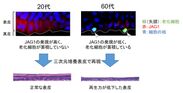 JAG1が老化細胞の排除を制御