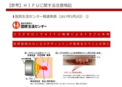 HIFUに関する注意喚起