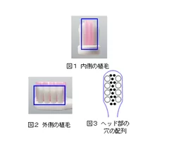 植毛イメージ図