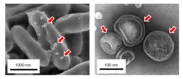 図2 生分解性プラスチック生産大腸菌からMVが隆起する瞬間を捉えた電子顕微鏡像