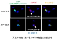 ANP32B発現の加齢変化