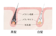 白髪へのアプローチ