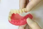 11. 歯ぐきと歯を接着