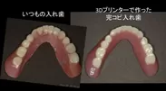 15. 完コピされた入れ歯を下から見ると。