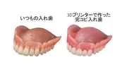 16. 3Dプリンターでいつも使っている入れ歯を完コピした「お守り入れ歯」左側