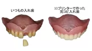 2. 歯が抜けている入れ歯を修復してコピー