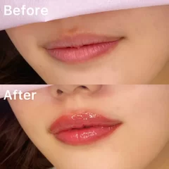 lip