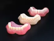 3Dプリンターで製造する義歯『ヨビーバ』