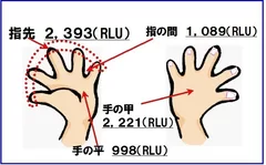 図1　1日オフィスワークを行った後の手の汚れ