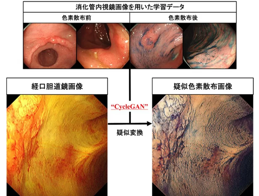 岡山大学病院と両備システムズ、
国内初となる胆道がんをAIで診断支援するシステムを開発