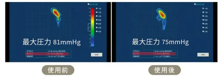 もう荷物を持つのが恐くない！どんな重い荷物でも一瞬で軽っと！
先行販売開始