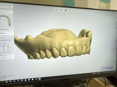 入れ歯データが3Dに変換