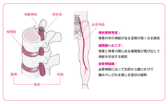 痛みやしびれを伴う代表的な疾患