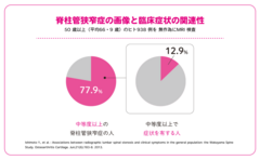 脊柱管がかなり狭くなっていても、約87％の人は、脊柱管狭窄症特有の痛みやしびれなどの症状は出ていない。