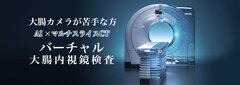 AI×マルチスライスCT　バーチャル大腸内視鏡検査を開始