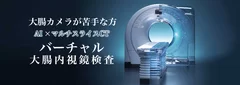 AI×マルチスライスCT　バーチャル大腸内視鏡検査を開始