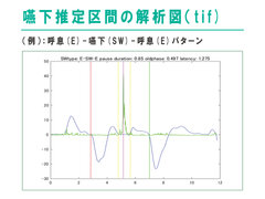 嚥下推定区間の解析図