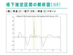 嚥下推定区間の解析図