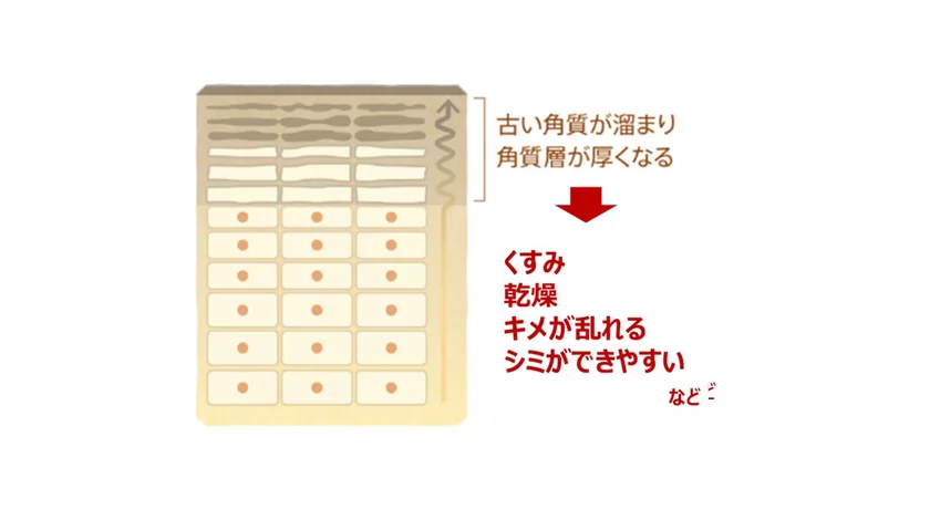 肌の断面図