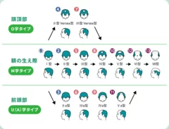 ハミルトン・ノーウッド分類表