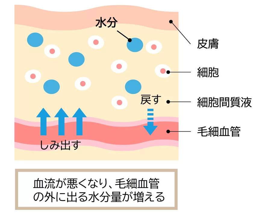 むくんでいる様子