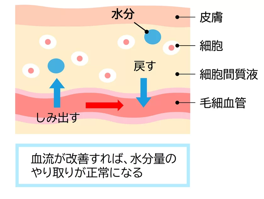 むくみが改善した様子