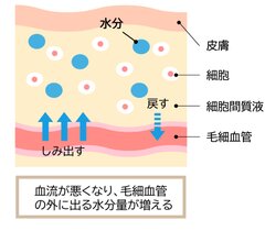 むくんでいる様子