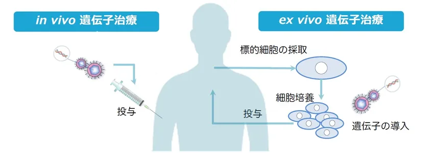 背景となる遺伝子治療のイメージ図