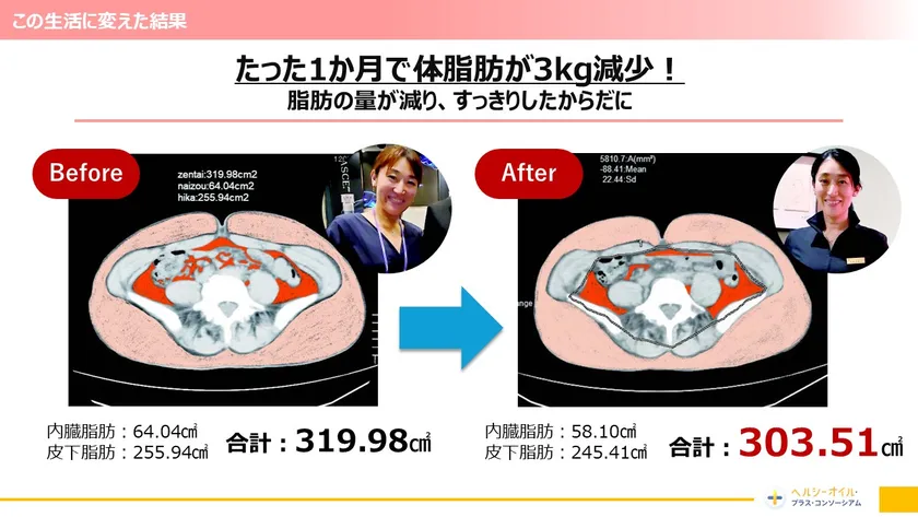 齋藤真理子先生自身もMCTオイルを使用し身体に変化があった