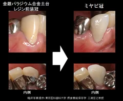 図3：ミヤビによる臨床例