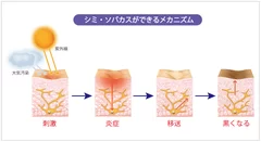 シミ・ソバカスができるメカニズム