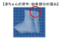 赤ちゃんの背中：仙骨部分の窪み