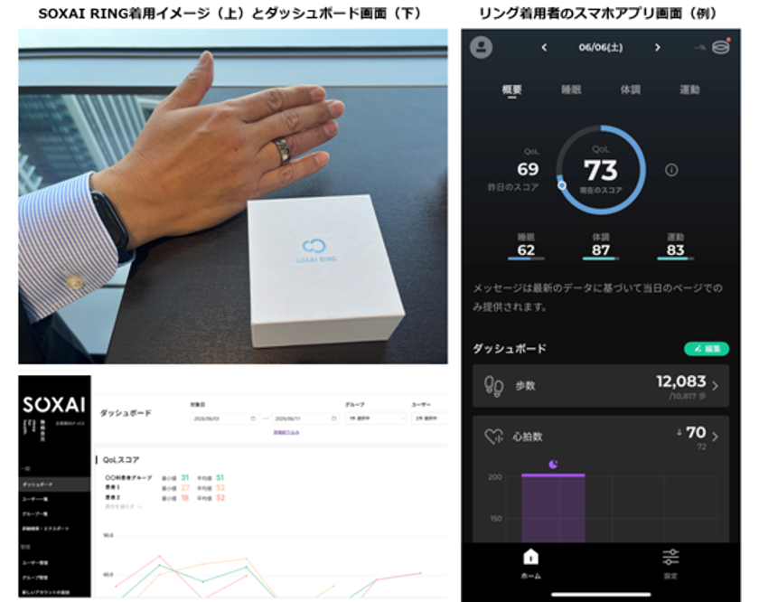 竹田健康財団とNTTドコモビジネス、スマートリングを活用した
術後患者の経過観察に関する実証実験を開始